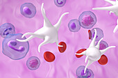 Essential thrombocythaemia, illustration