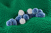 T cells attacking prostate cancer cells, illustration