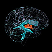 Third brain ventricle, illustration