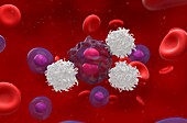 T cells attacking lymphoma cell, illustration
