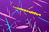 Uric acid crystals, illustration