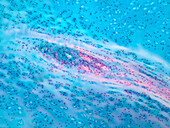 Human hyaline cartilage, light micrograph