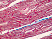 Human cardiac muscle, light micrograph