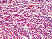 Human liver tissue, light micrograph