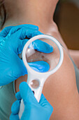 Dermatologist checking mole
