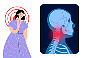 Neck pain, conceptual illustration