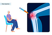 Injection for knee pain, illustration