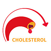 High cholesterol, conceptual illustration