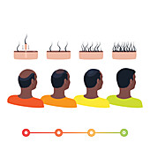 Hair transplantation, conceptual illustration