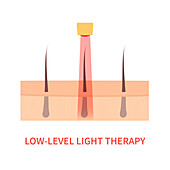 Light therapy, conceptual illustration