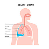 Urinothorax, illustration