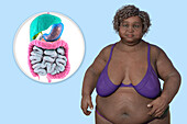 Overweight woman and digestive system, illustration