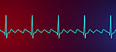 Atrial flutter abnormal heartbeat rhythm, illustration