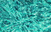 GMS stain collagen fibres, light micrograph