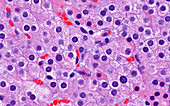 Parathyroid gland cells, light micrograph