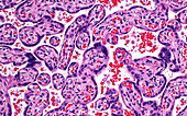 Placenta villi, light micrograph