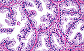Prostate glands, light micrograph