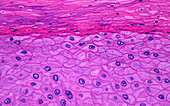Skin epidermis squamous cells, light micrograph