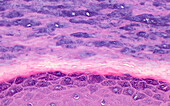 Skin epidermis with lucidum layer, light micrograph