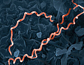 Treponema pallidum syphilis bacteria, SEM