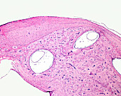 Semicircular canals, light micrograph