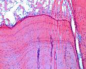 Sharpey's fibres, light micrograph