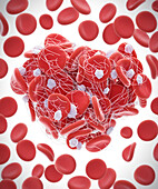 Blood clot, illustration