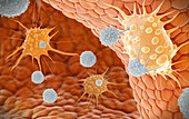Natural killer T cells attacking cancer cells, illustration