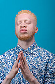 Studio portrait of albino man in blue patterned shirt with eyes closed