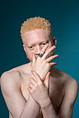 Studioporträt eines Albino-Mannes ohne Hemd