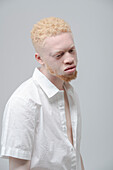 Studio portrait of albino man in white shirt