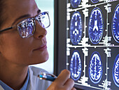 Doctor analyzing brain scan for damage or disease