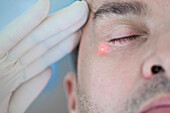 Mann erhält Laserbehandlung im Gesicht