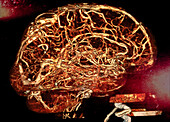 Cerebral arteries, CT angiogram