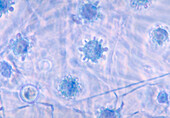 Histoplasma capsulatum fungus, light micrograph