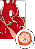 Normal aortic valve, illustration