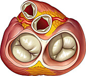 Normal heart valves, diastole, illustration