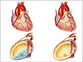 Blood supply to the left ventricle, illustration