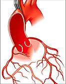 Aortic root with coronary arteries, illustration