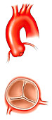 Aortic valve, illustration