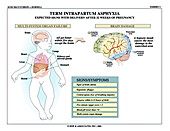 Signs of term intrapartum asphyxia, illustration