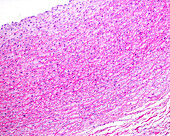 Tunica media of elastic arterya , light micrograph
