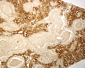Spleen macrophages, light micrograph