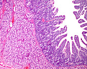 Brunner glands in duodenum, light micrograph