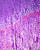 Bone epiphyseal growth plate, light micrograph