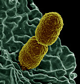 White blood cell interacting with Klebsiella pneumoniae bacterium, SEM