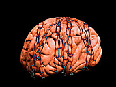 Imprisoned brain, conceptual illustration