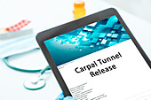 Carpal tunnel release