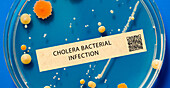 Cholera bacterial infection