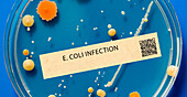 E coli infection